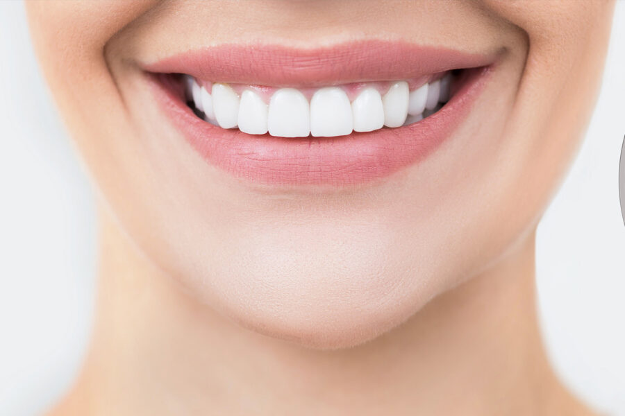 Perfect smile