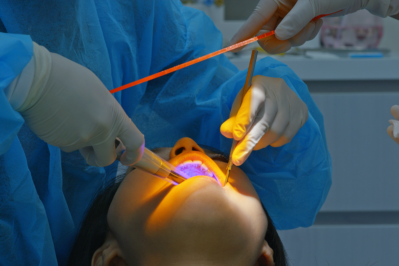 dentist using dental laser in patient's mouth