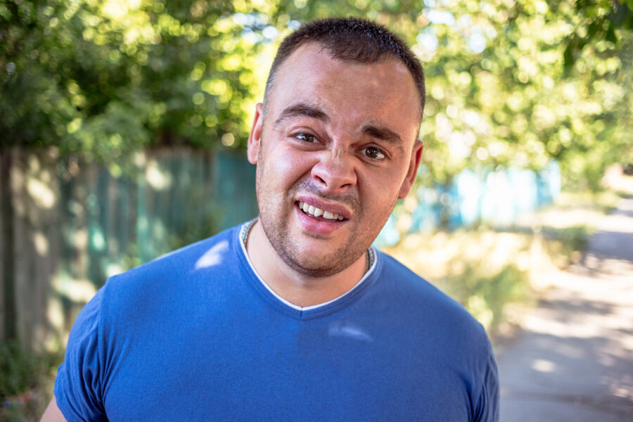 smiling man showing chipped tooth