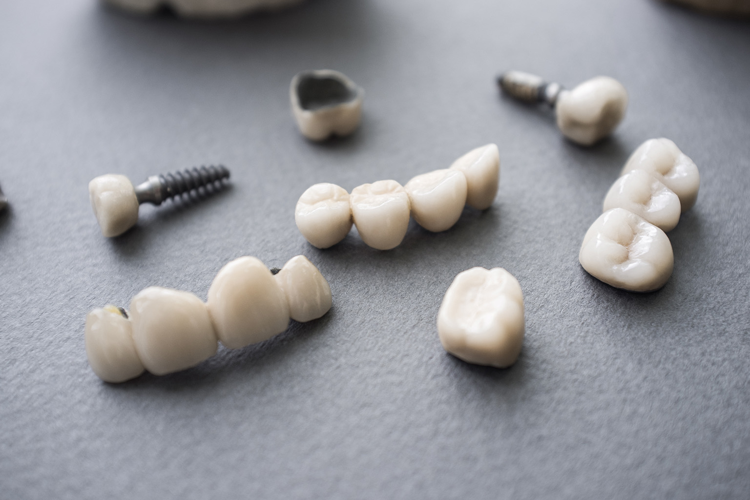 assortment of implants, crowns, and bridges on surface