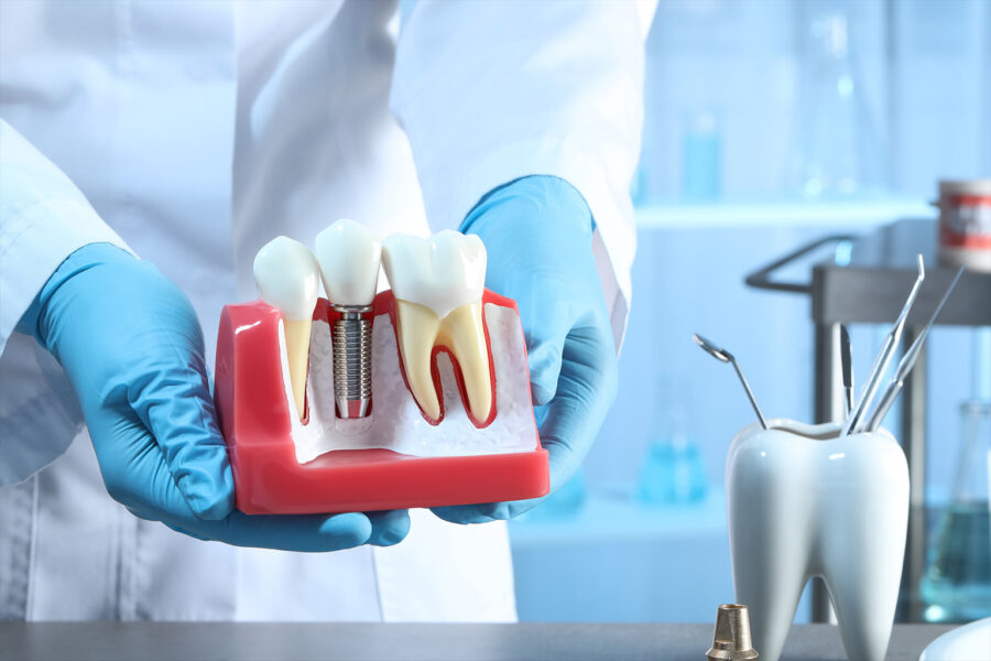 gloved hands holding model of dental implant between two teeth