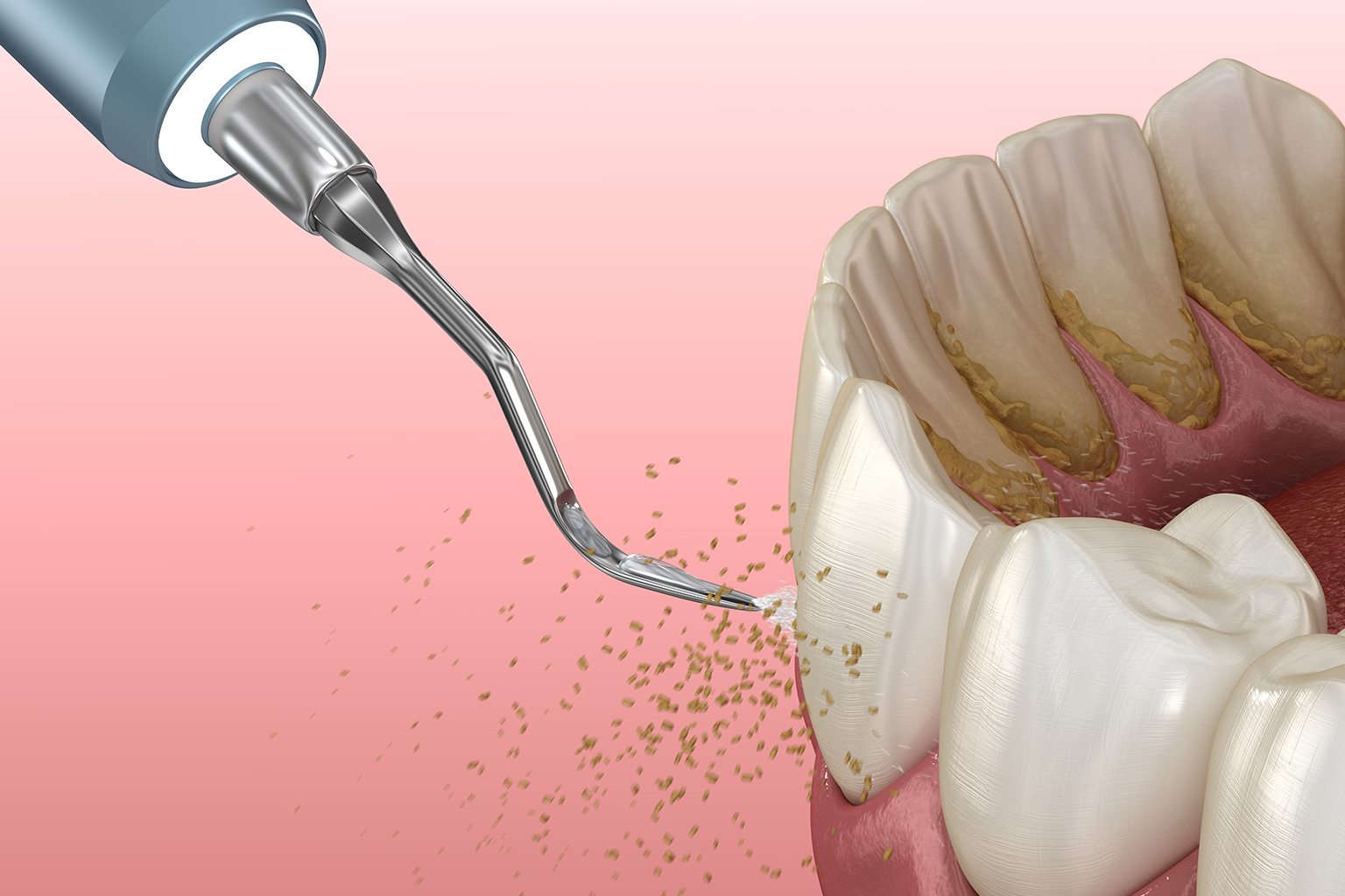 rendering of a dental tool cleaning building off front of teeth with water