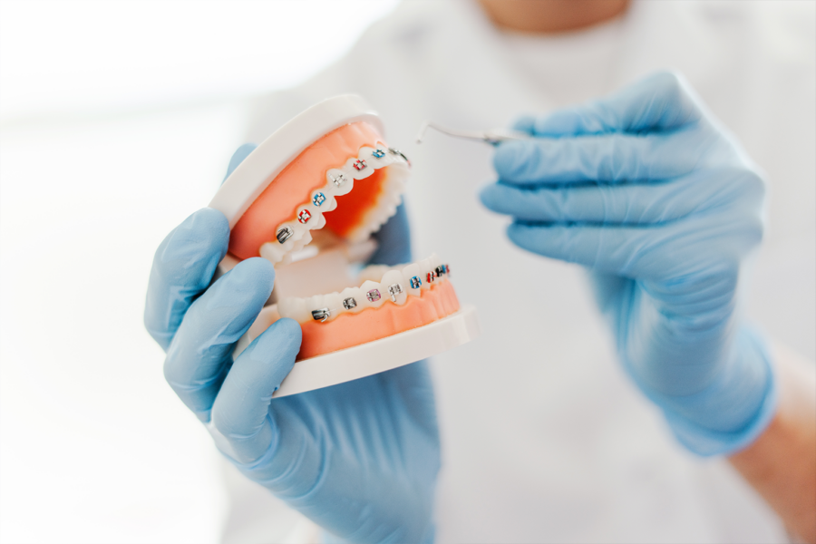 gloved hands holding mouth model with braces