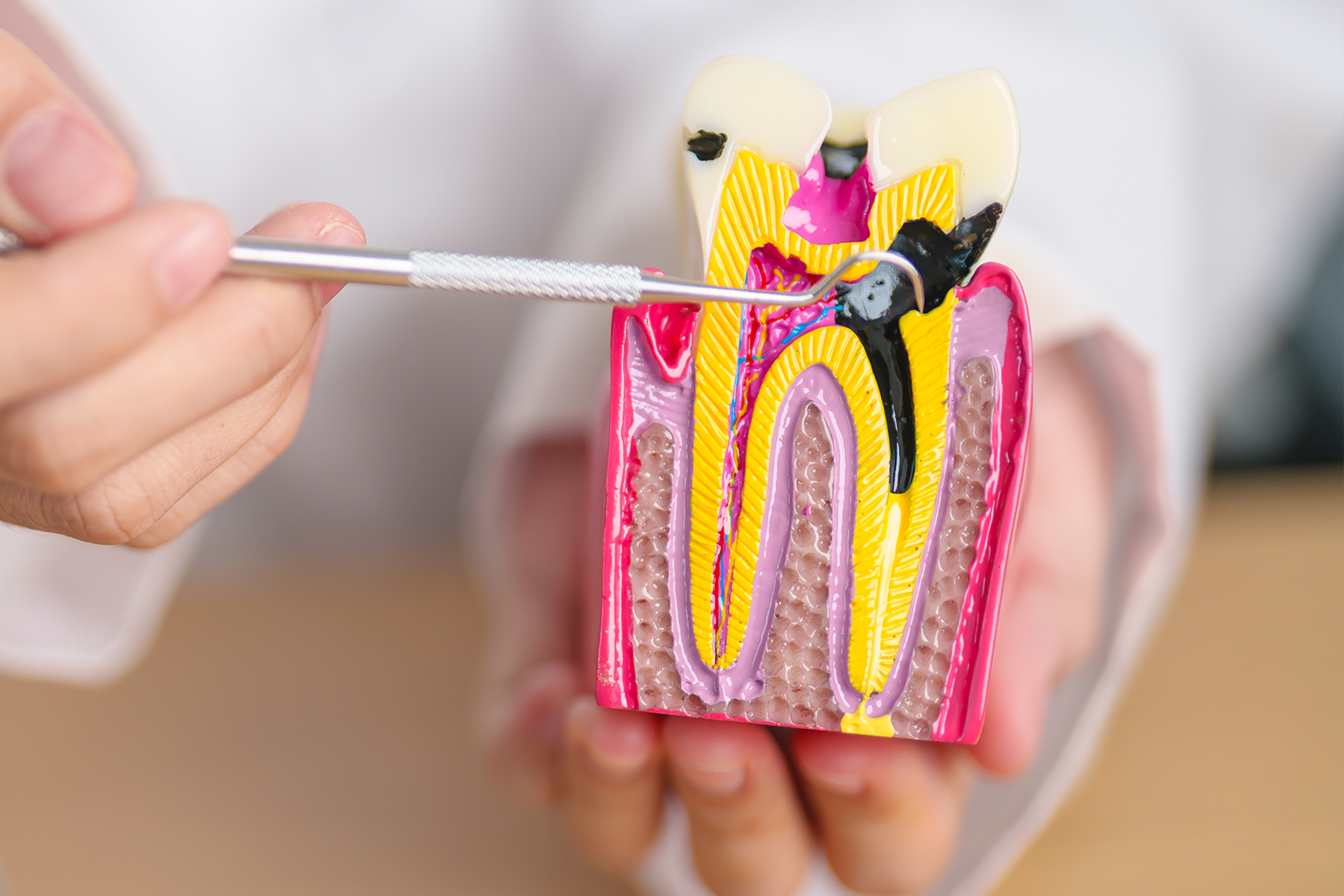 hands pointing to tooth model with dental tool