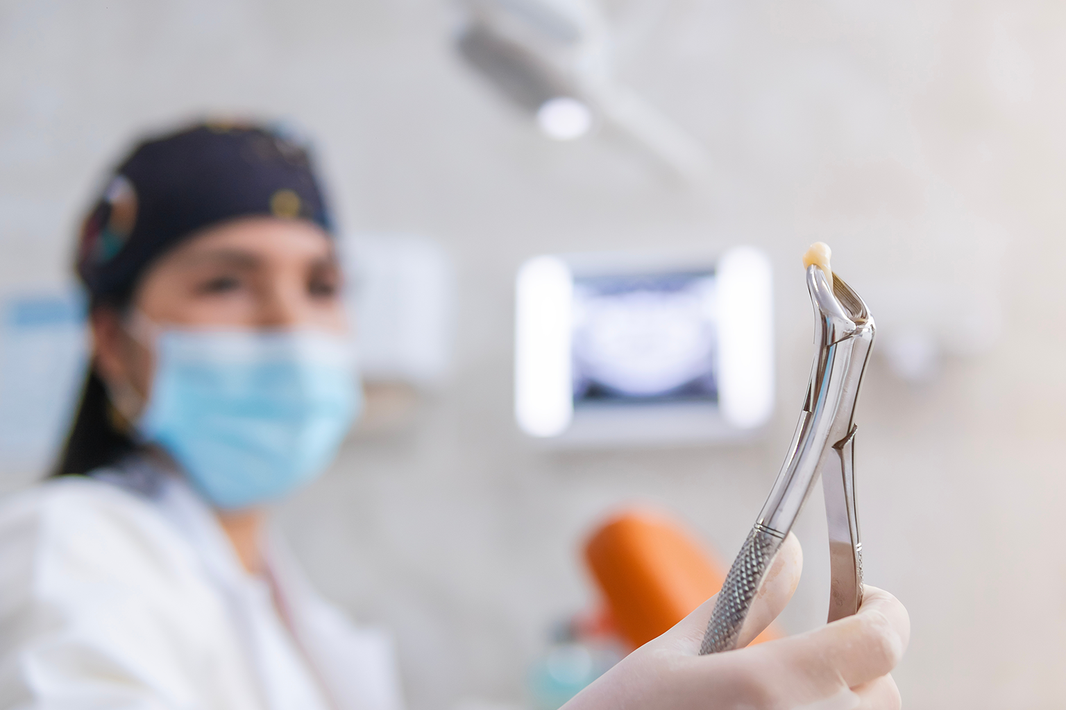 dentist holding extracted tooth in dental pliers