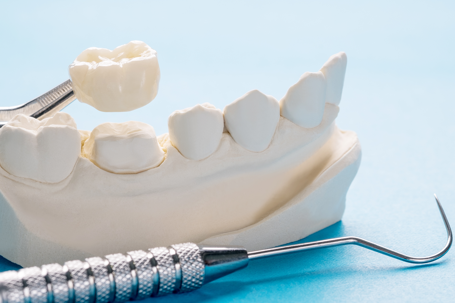 dental tool placing dental crown onto jaw model