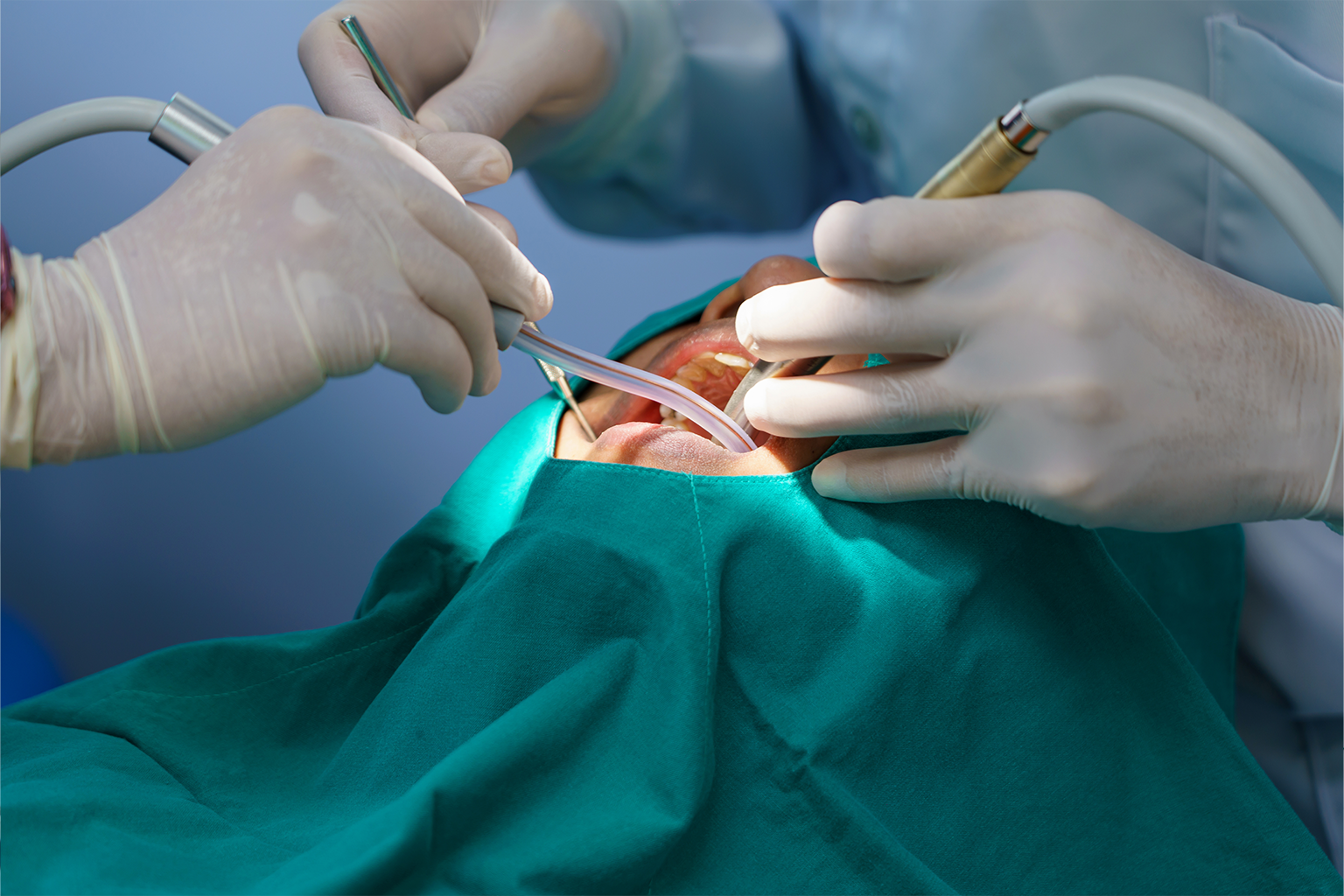 gloved hands using dental tools in patient's mouth