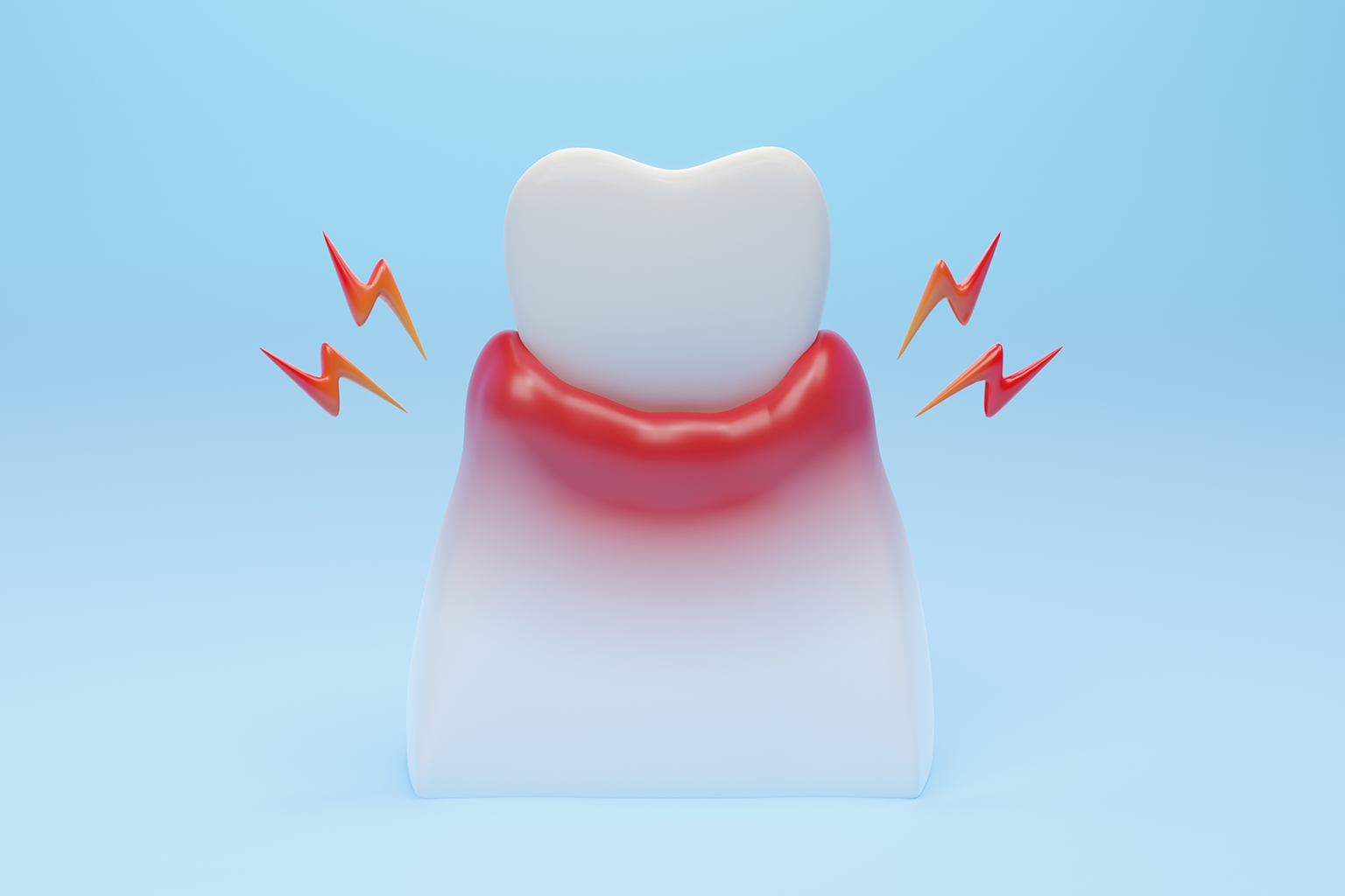 rendering of a tooth with inflamed gums