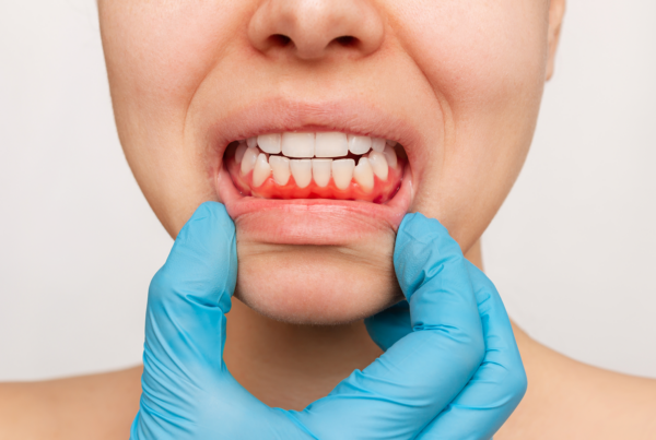 gloved hand pulling down woman's lip to show gums