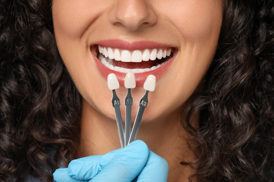 gloved hand holding shade-matching tool against woman's smile