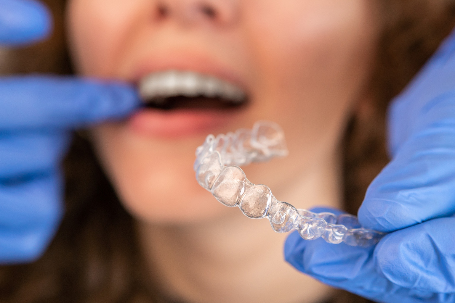 gloved hands holding clear aligner in front of woman's face