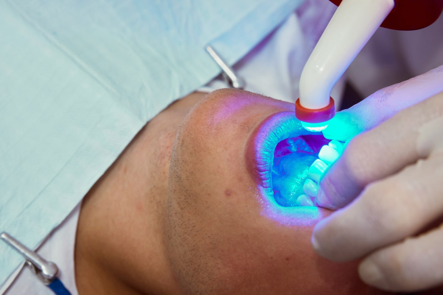 Dentist shining whitening light on patient's teeth.