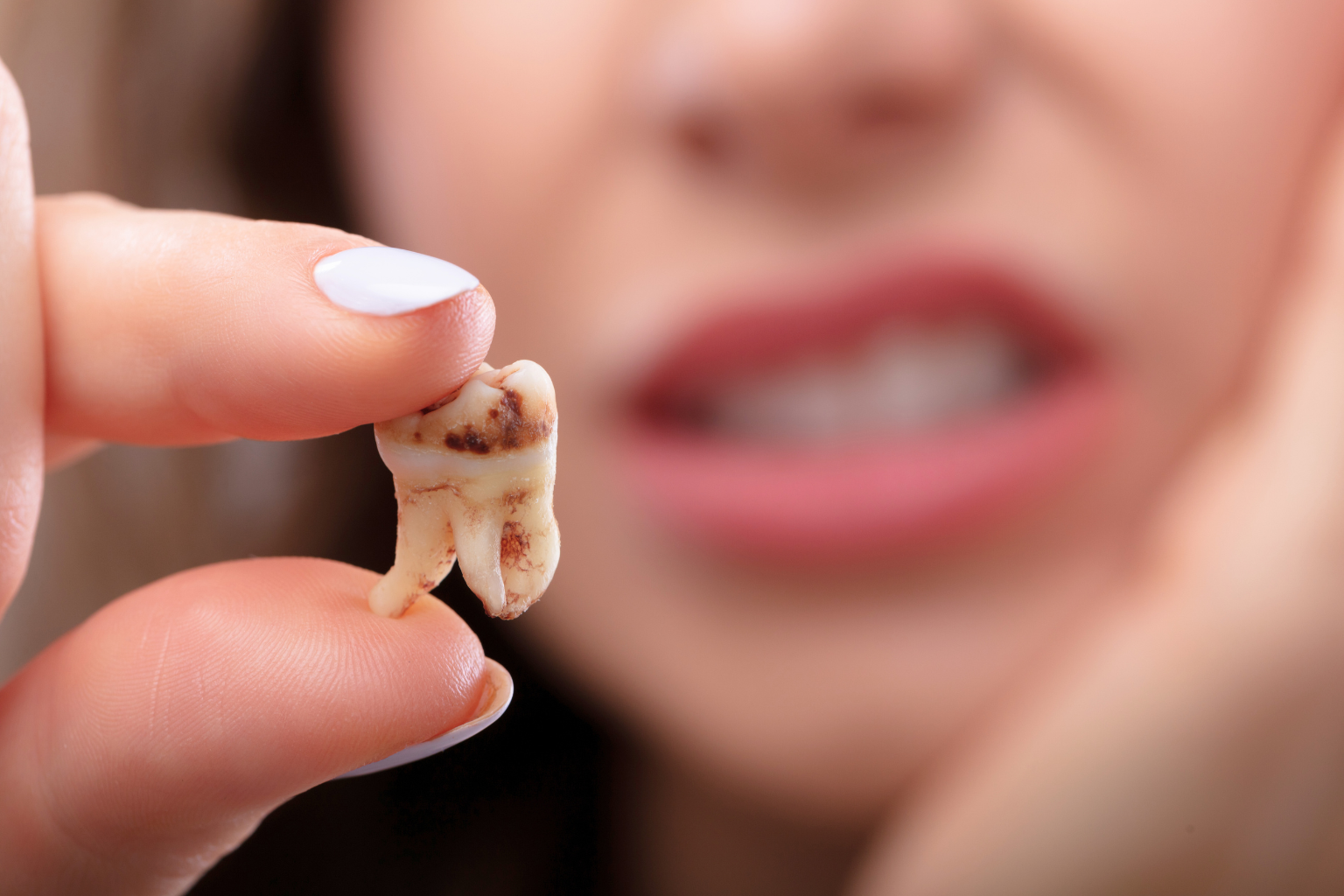 Woman holding a tooth between her fingers.