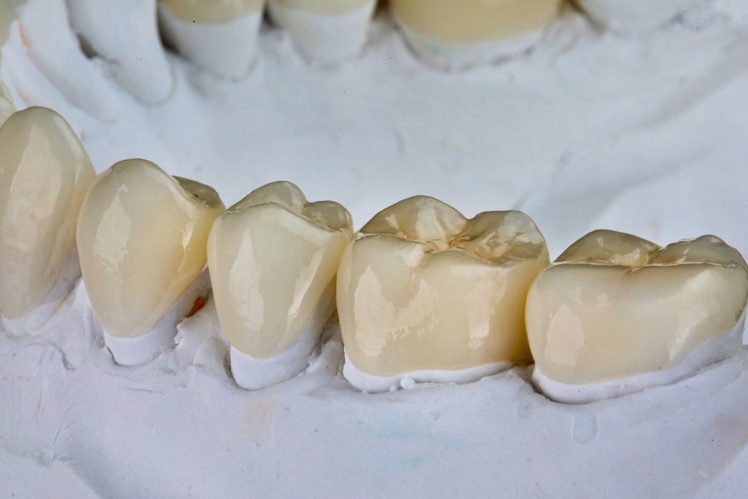 lower mandible model with dental crowns