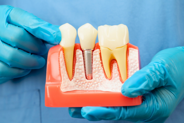 Gloved hands holding jaw model with implant and crown.