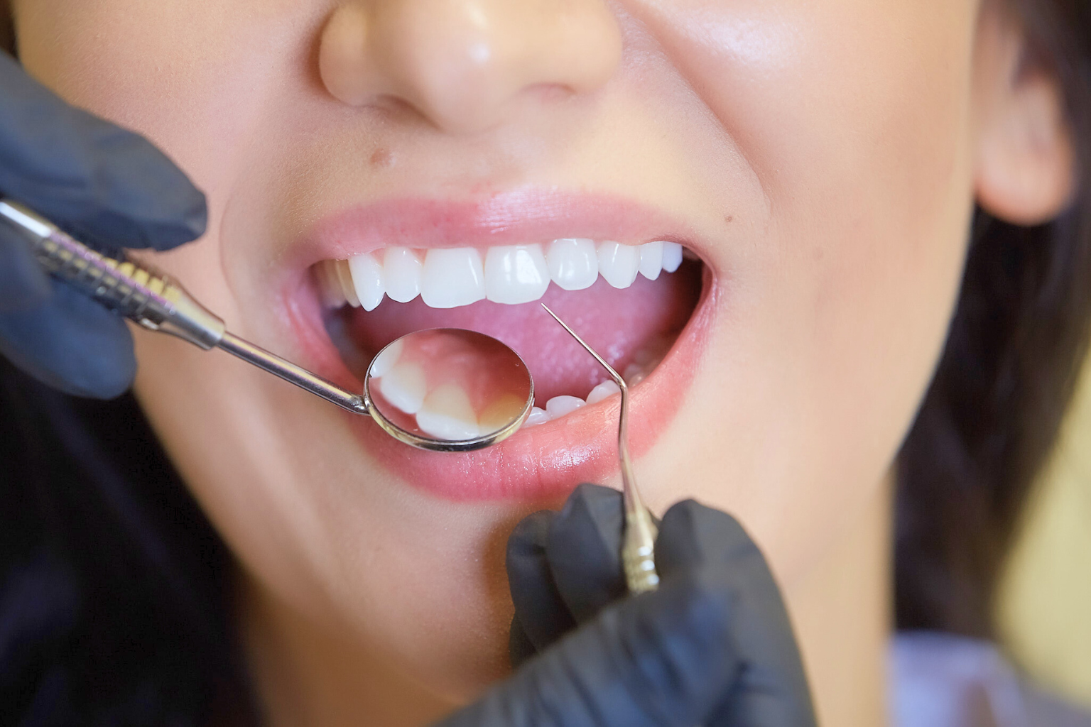 Gloved hands using dental tools in woman's mouth.