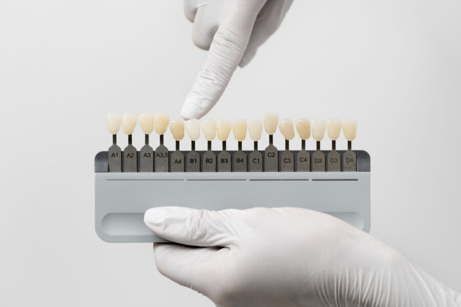 Dentist comparing tooth shades with a dental shade guide to match the natural color for a crown, veneer, or other cosmetic dental restoration.