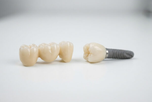 Dental bridge and dental implant with crown on white surface.