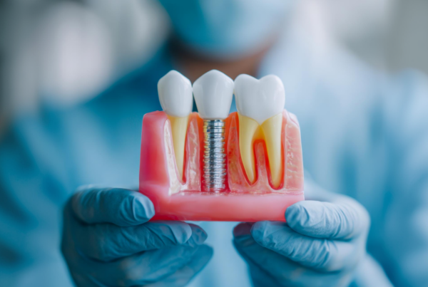 Gloved hand holding a model of a dental implant between two teeth.